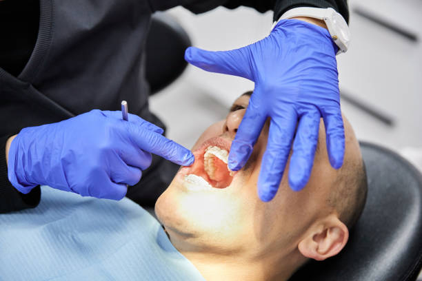 Best Emergency Wisdom Tooth Extraction in Flat Rock, NC
