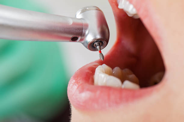 Reliable NC Emergency Dental Service Solutions